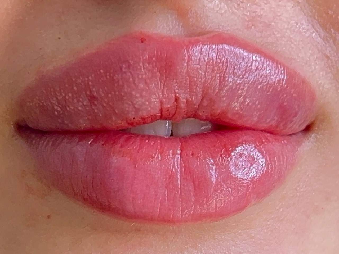 نتيجة علاج في Natour Clinic 7