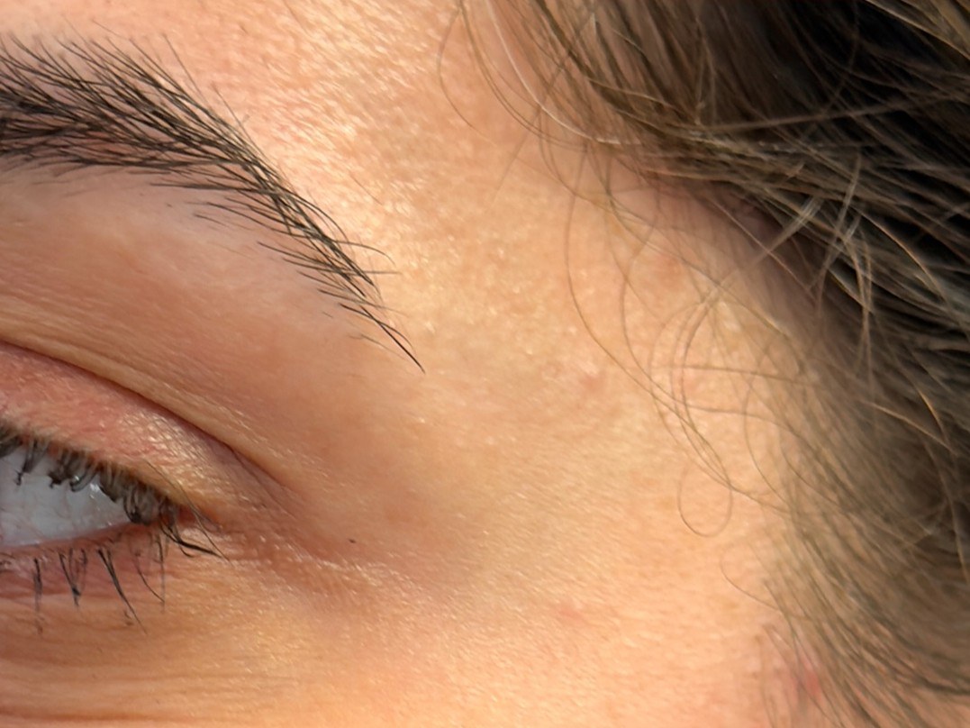 نتيجة علاج في Natour Clinic 5