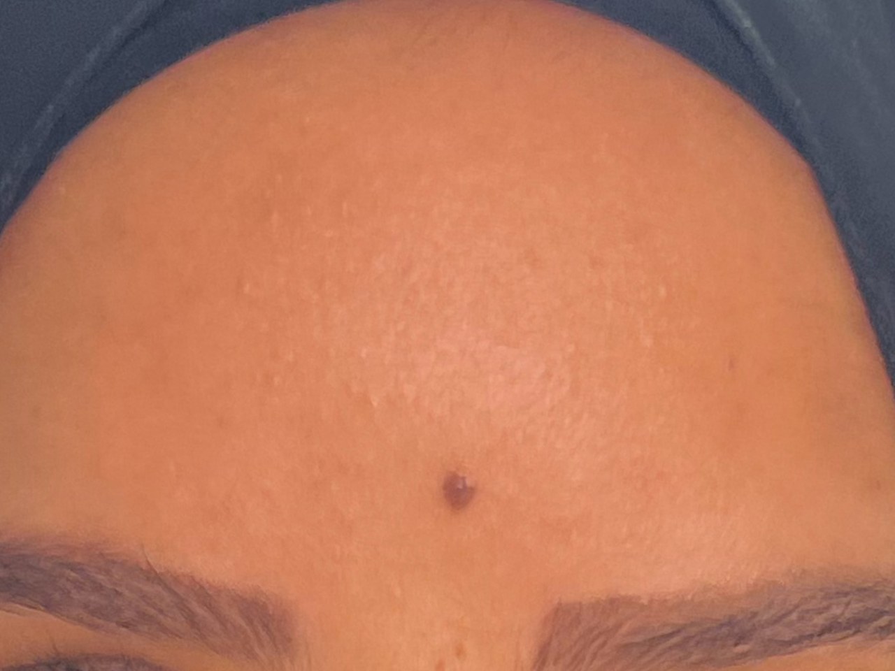 نتيجة علاج في Natour Clinic 6
