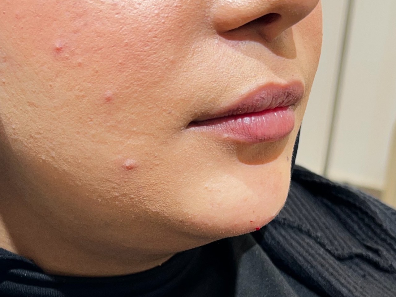 نتيجة علاج في Natour Clinic 11